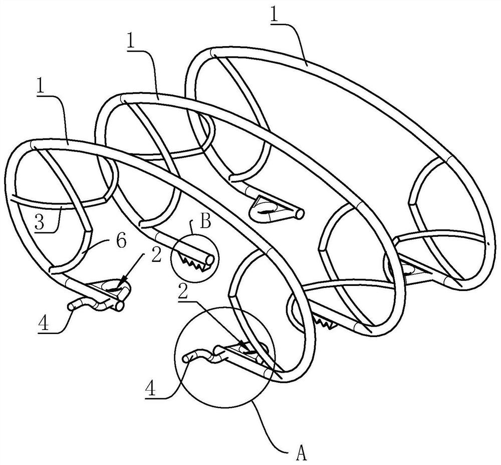 Glaucoma drainage device