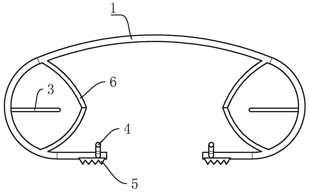 Glaucoma drainage device