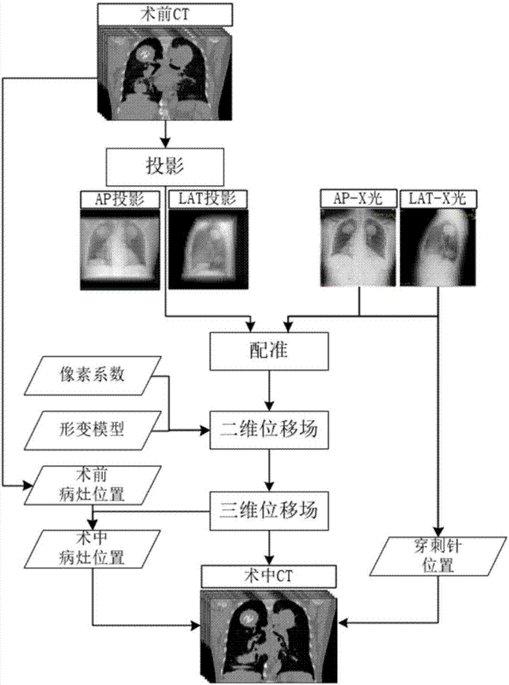 Lung puncture operation positioning method under guidance of X-ray and preoperative CT