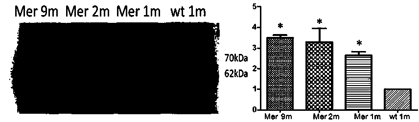 A composition for improving the effect of gene therapy for retinal degenerative diseases and its application