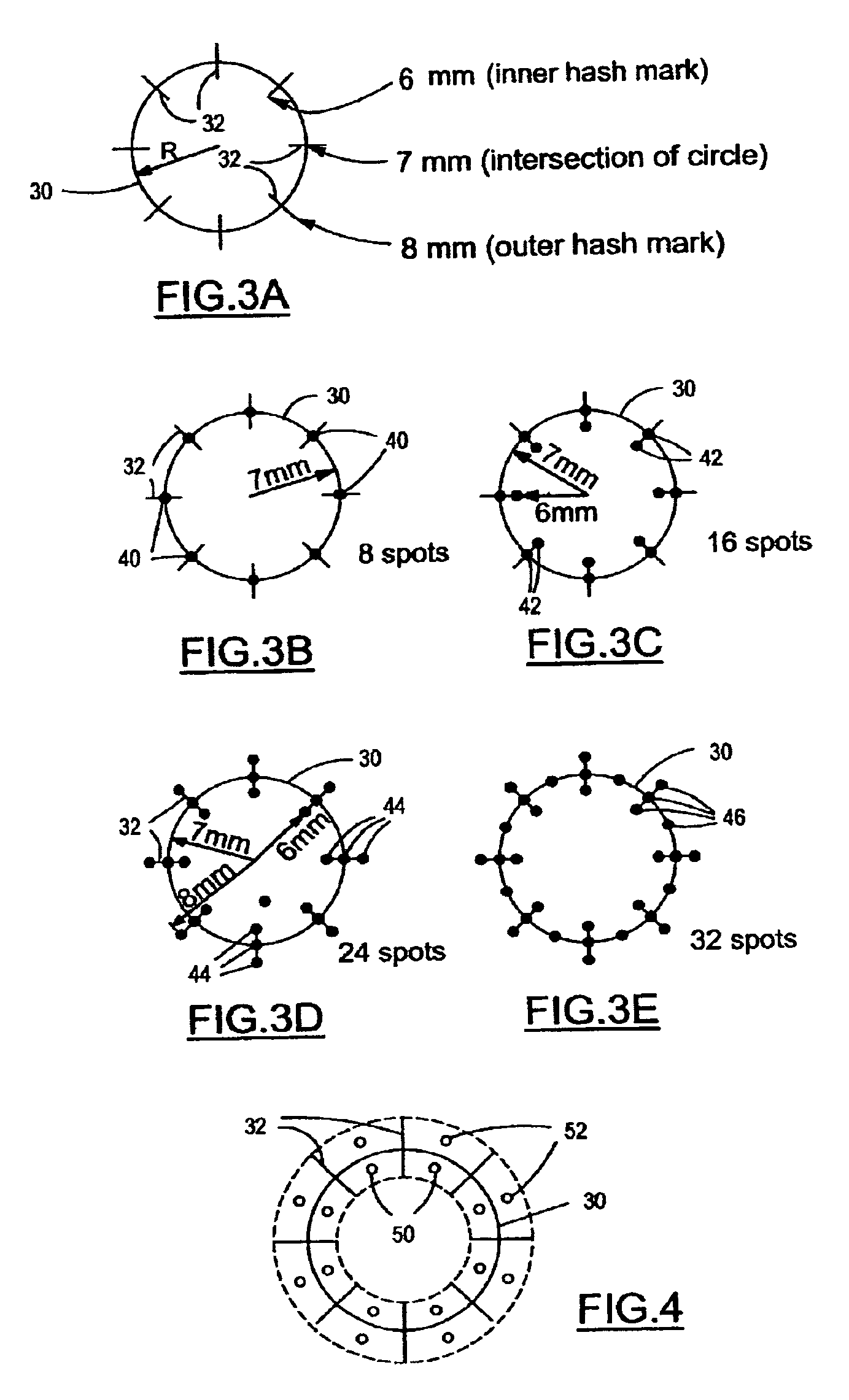 Method and system for conductive keratoplasty