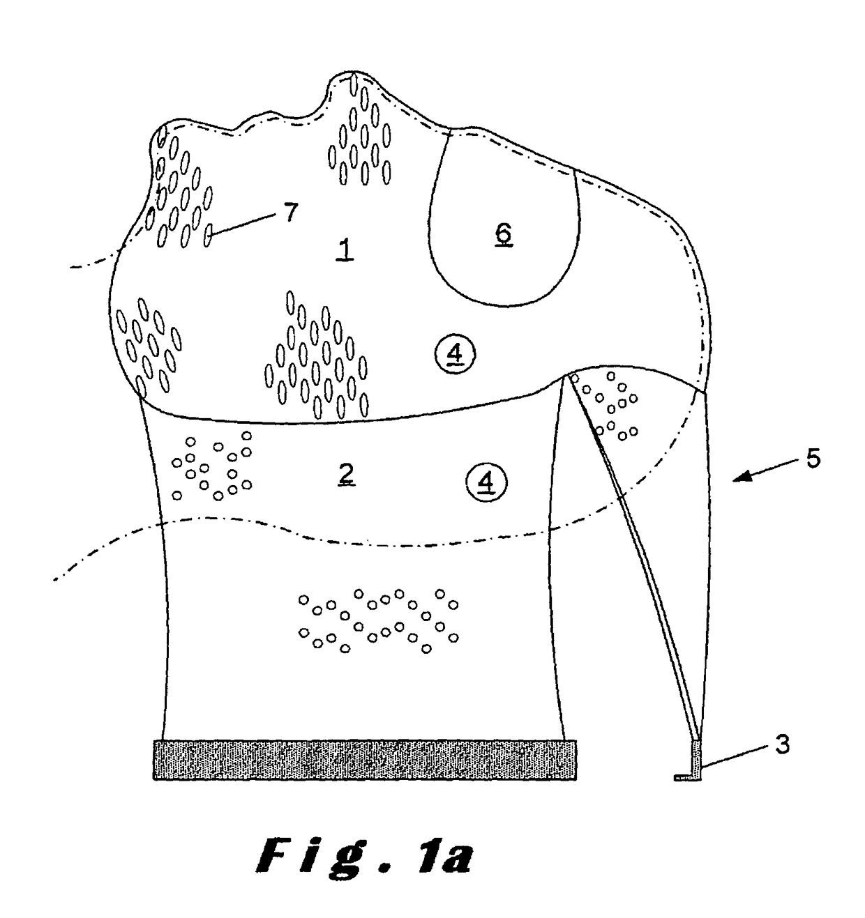 Hybrid immobilisation device