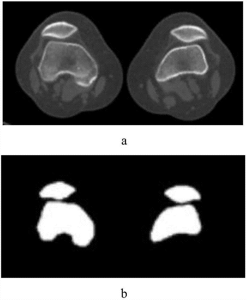 Knee osteoarthritis course detection method based on near-infrared light