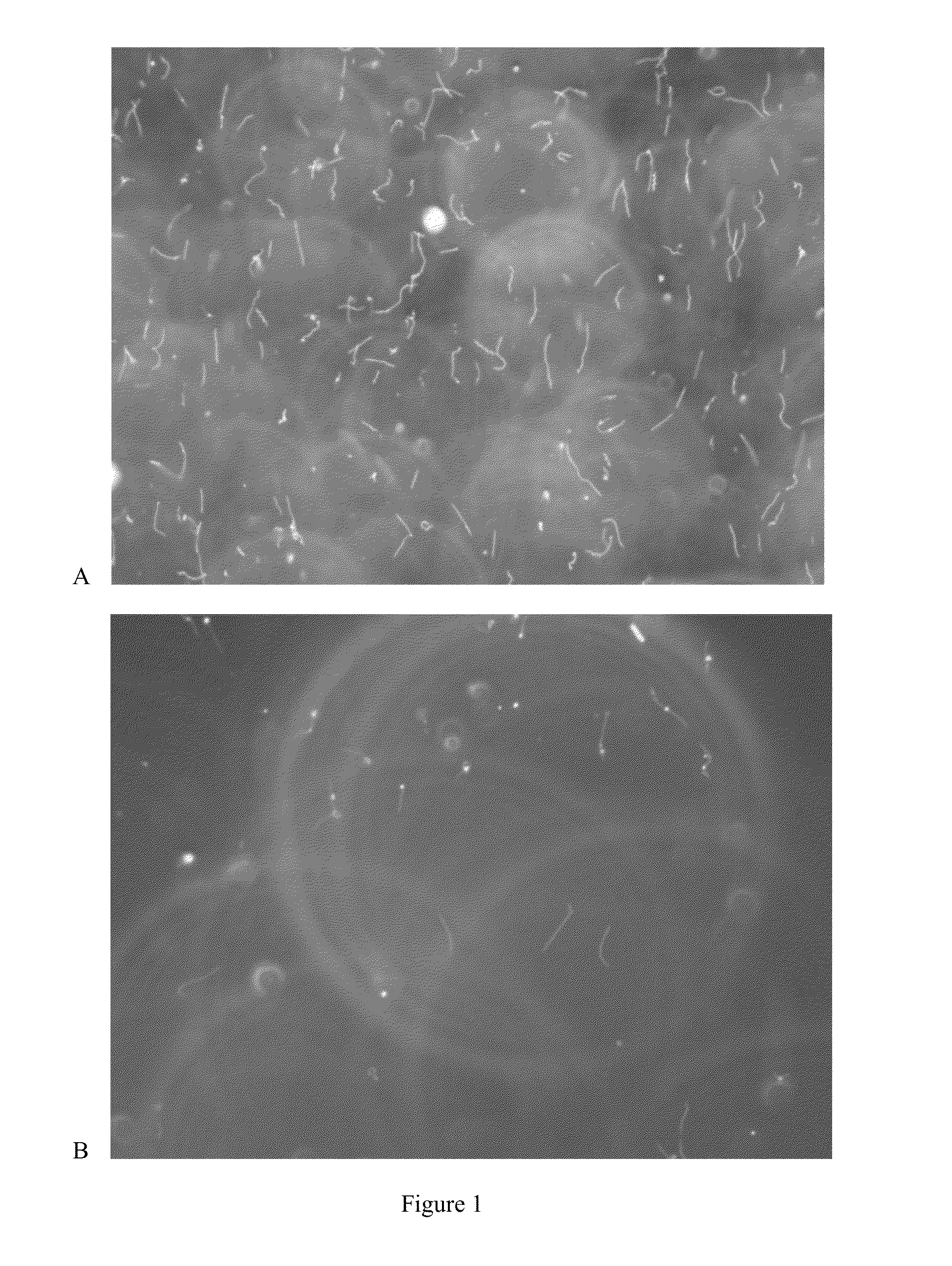 Compositions and methods for culturing spirochetes