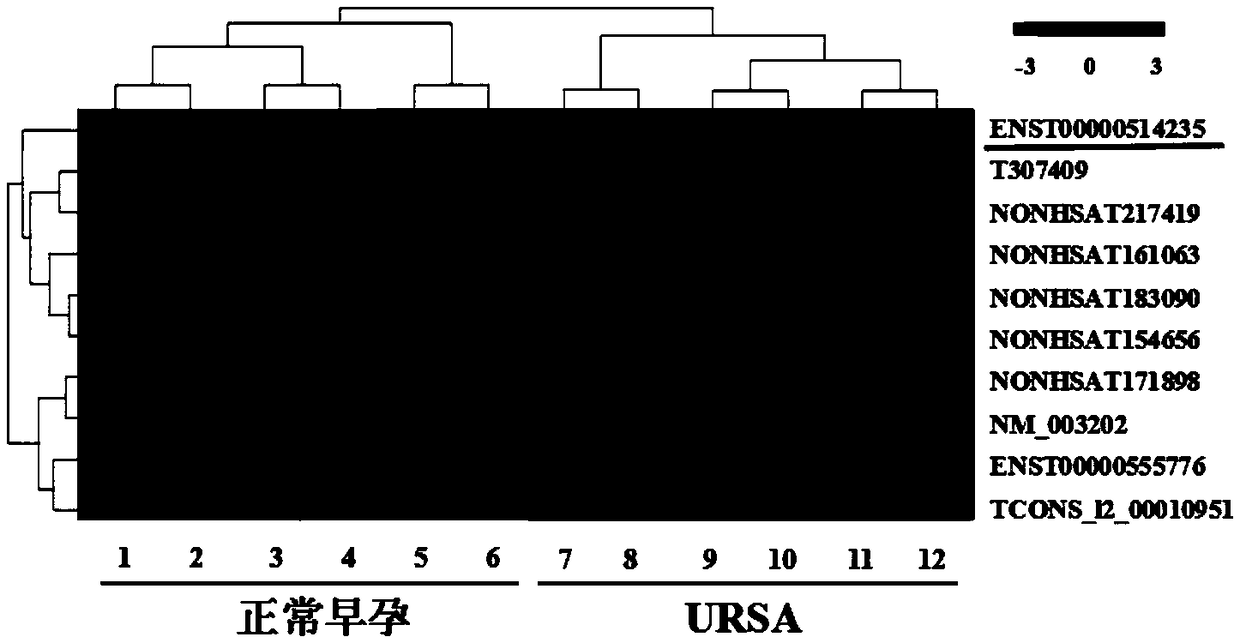 Application of LncRNA in serum as marker for URSA (unexplained recurrent spontaneous abortion) diagnosis and pregnancy outcome evaluation