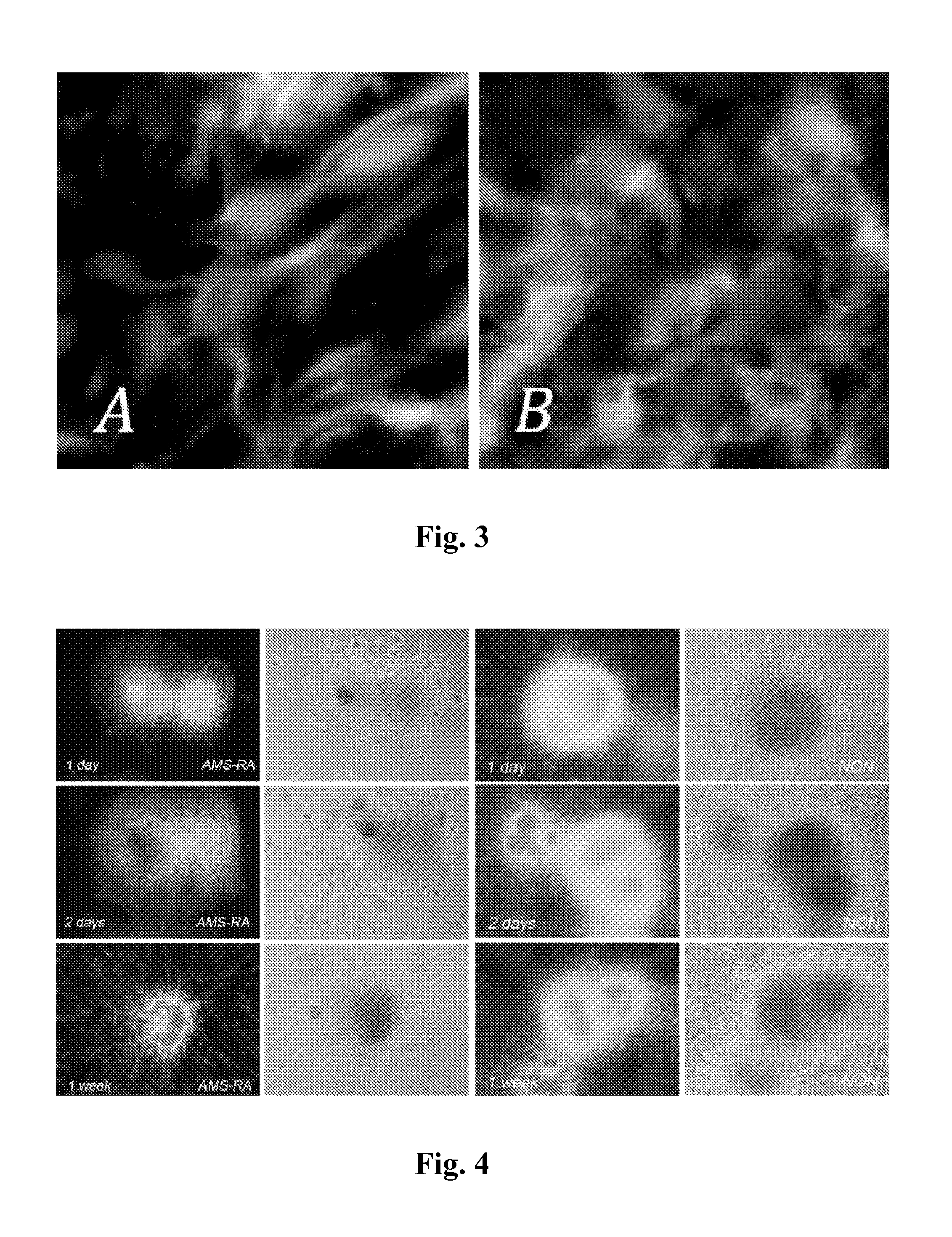 Method for stem cell differentiation in vivo by delivery of morphogenes with mesoporous silica and corresponding pharmceutical active ingredients