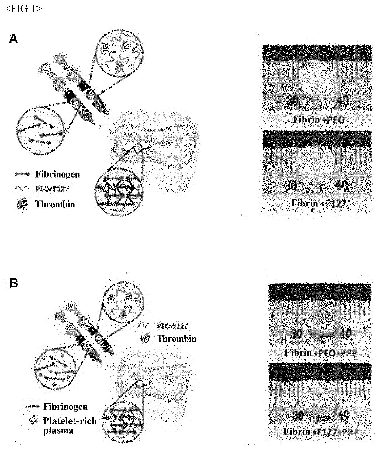Composition for regeneration of human fibrous cartilage or elastic cartilage