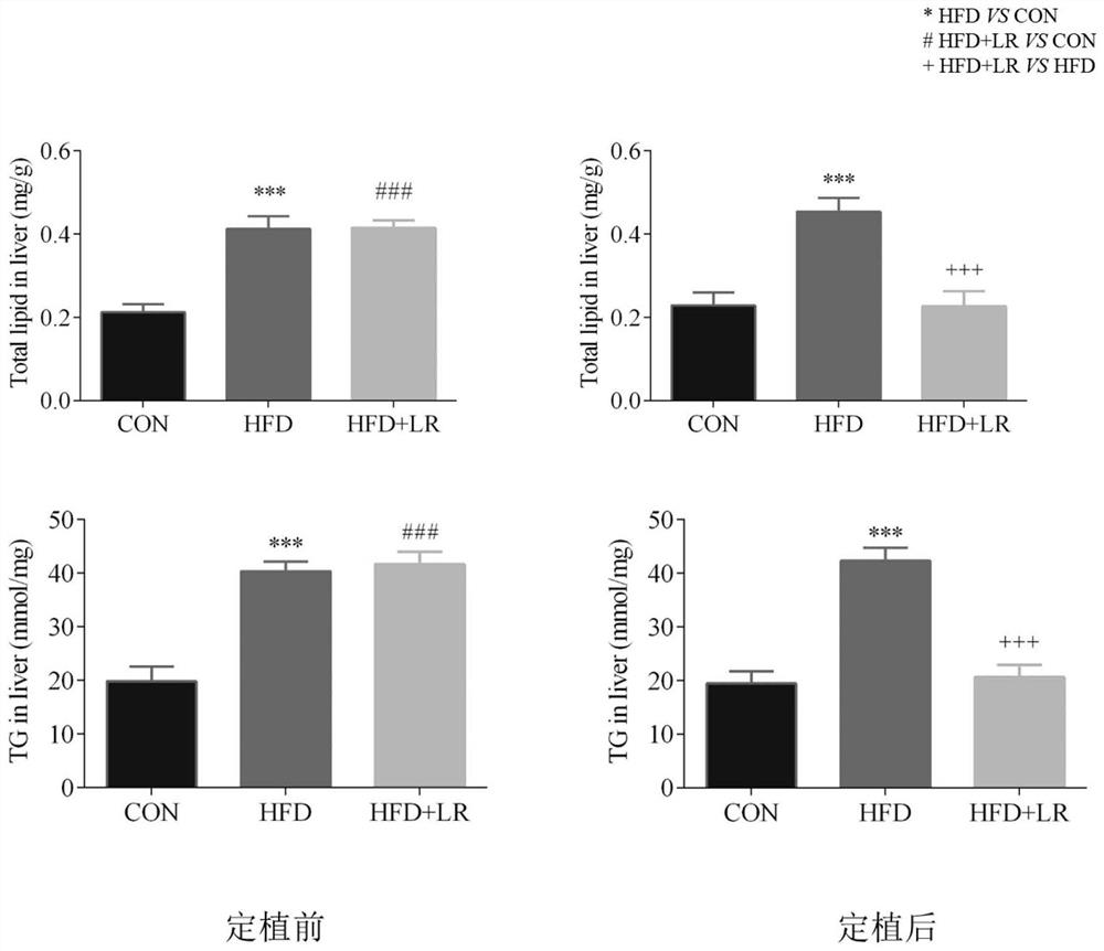 Application of Lactobacillus reuteri live bacteria in preparing medicine for treating or alleviating symptoms of non-alcoholic fatty liver disease