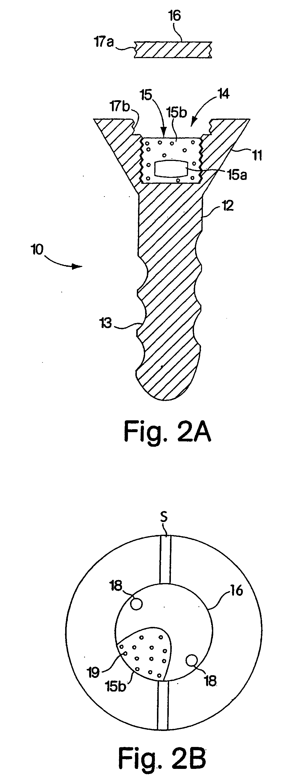 Device and method for treating conditions of a joint