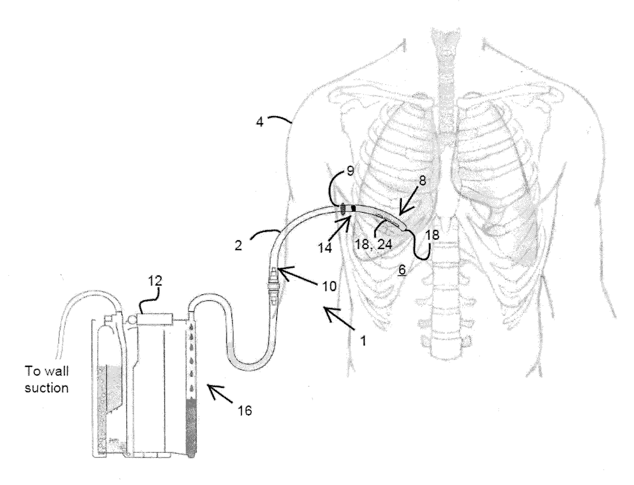 Thoracic catheter device