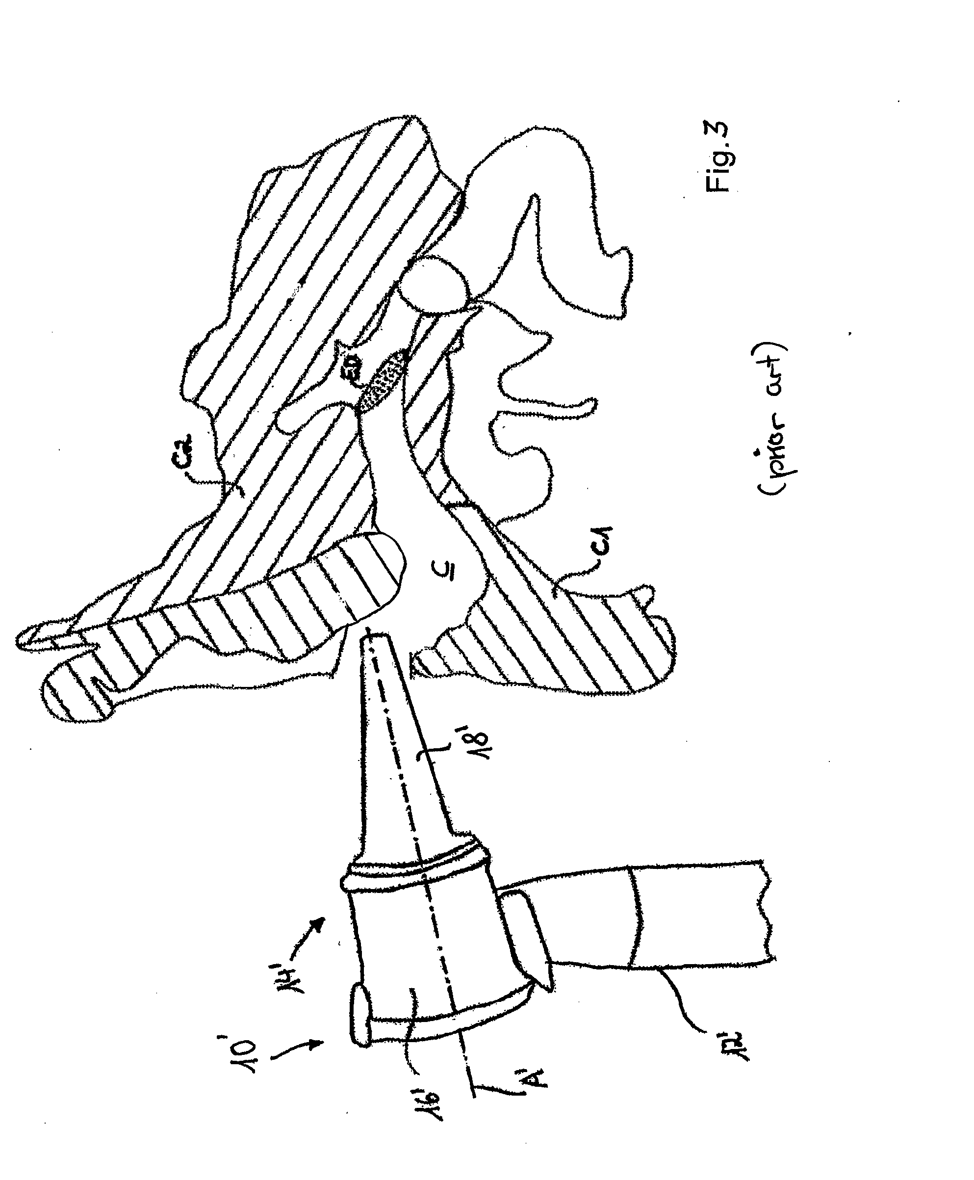 Method for identifying objects in a subject's ear