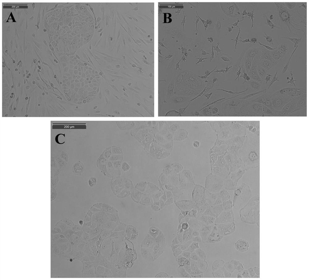 A kind of human ovarian cancer cell line and its preparation method and application