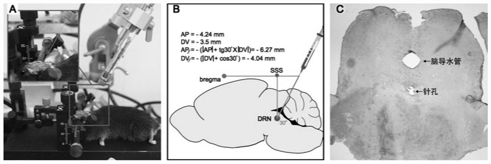 Construction method of mouse depression model - Eureka | Patsnap