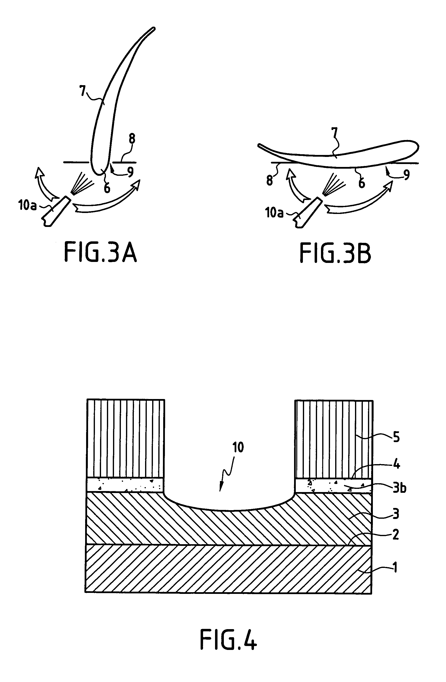 Method of locally repairing parts covered with a thermal barrier