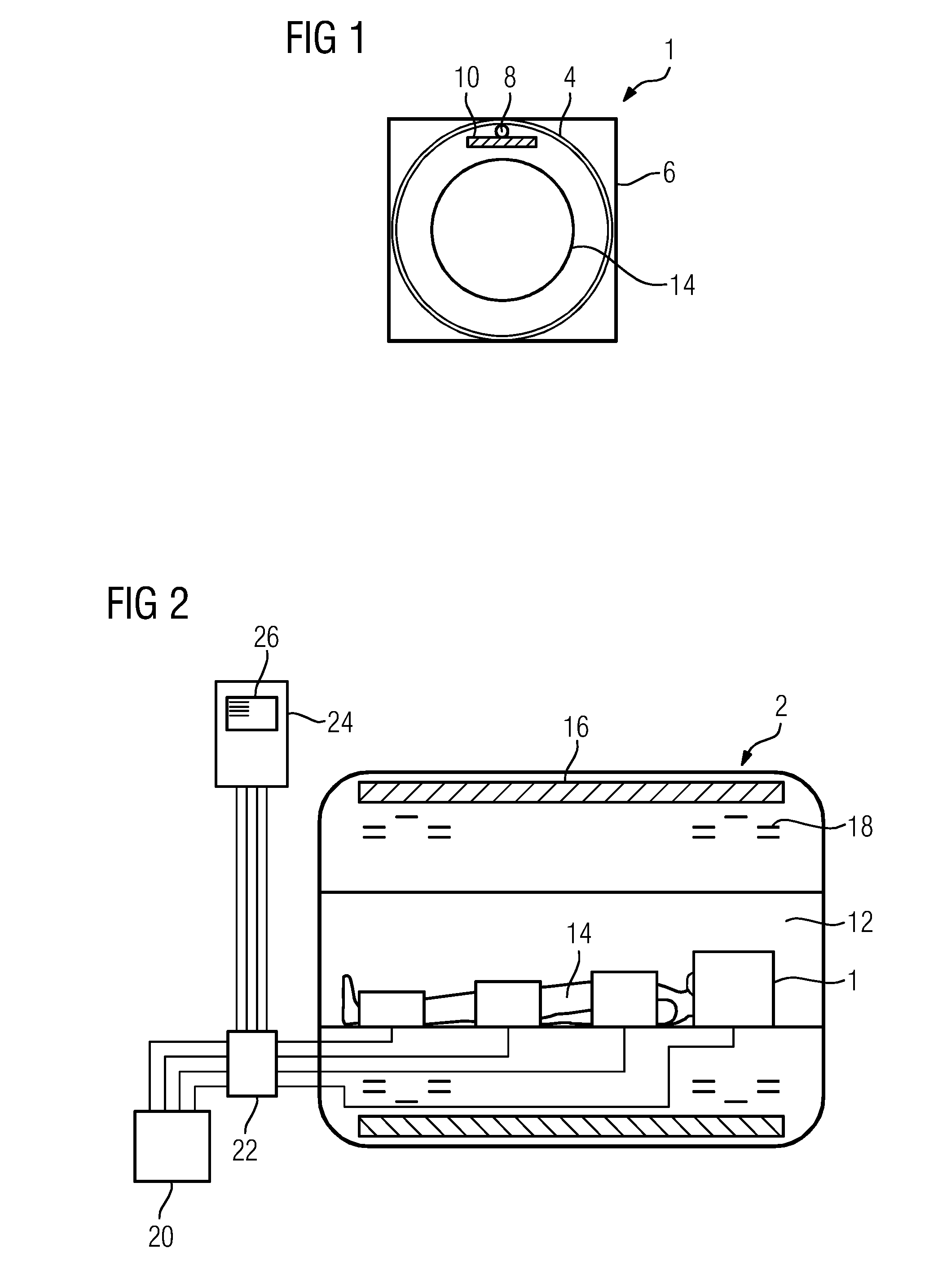 Local Coil for a Coil System of a Magnetic Resonance Imaging System