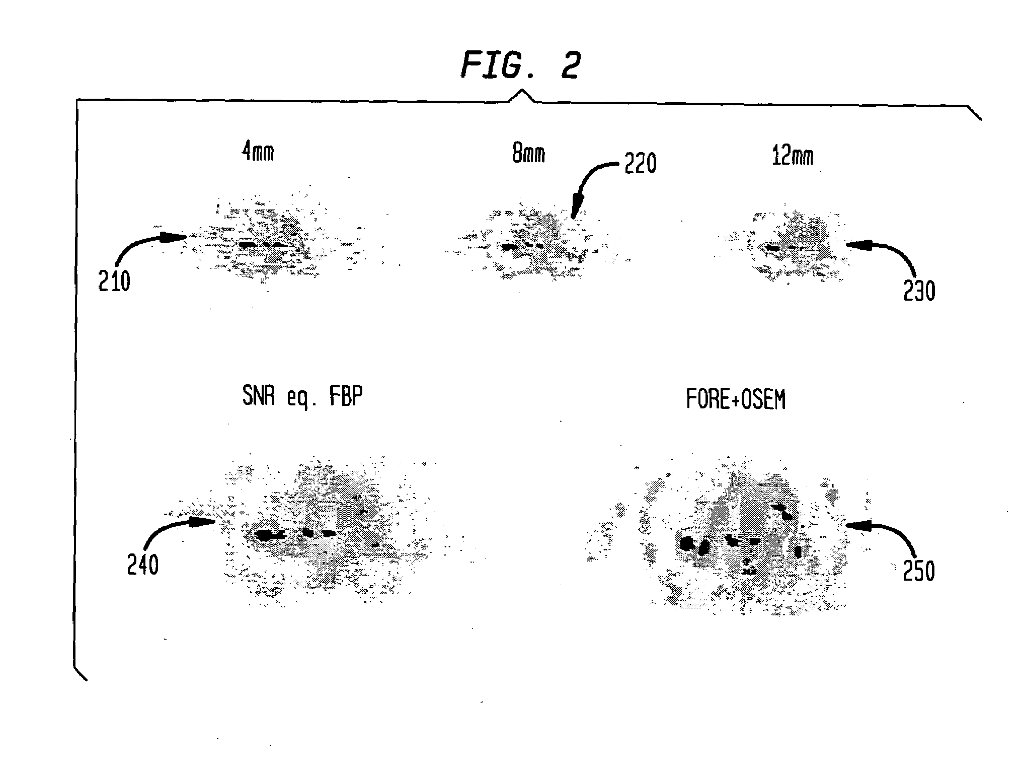 Spatially localized noise adaptive smoothing of emission tomography images