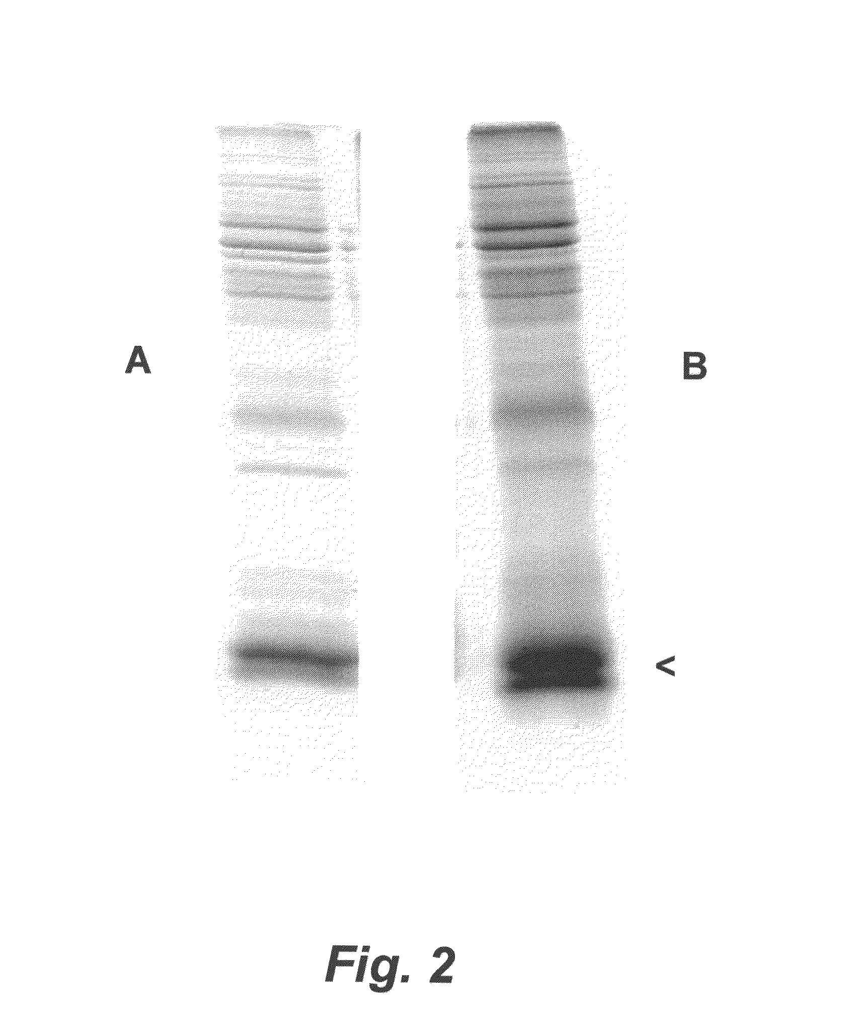 Porcine <i>Helicobacter </i>infection