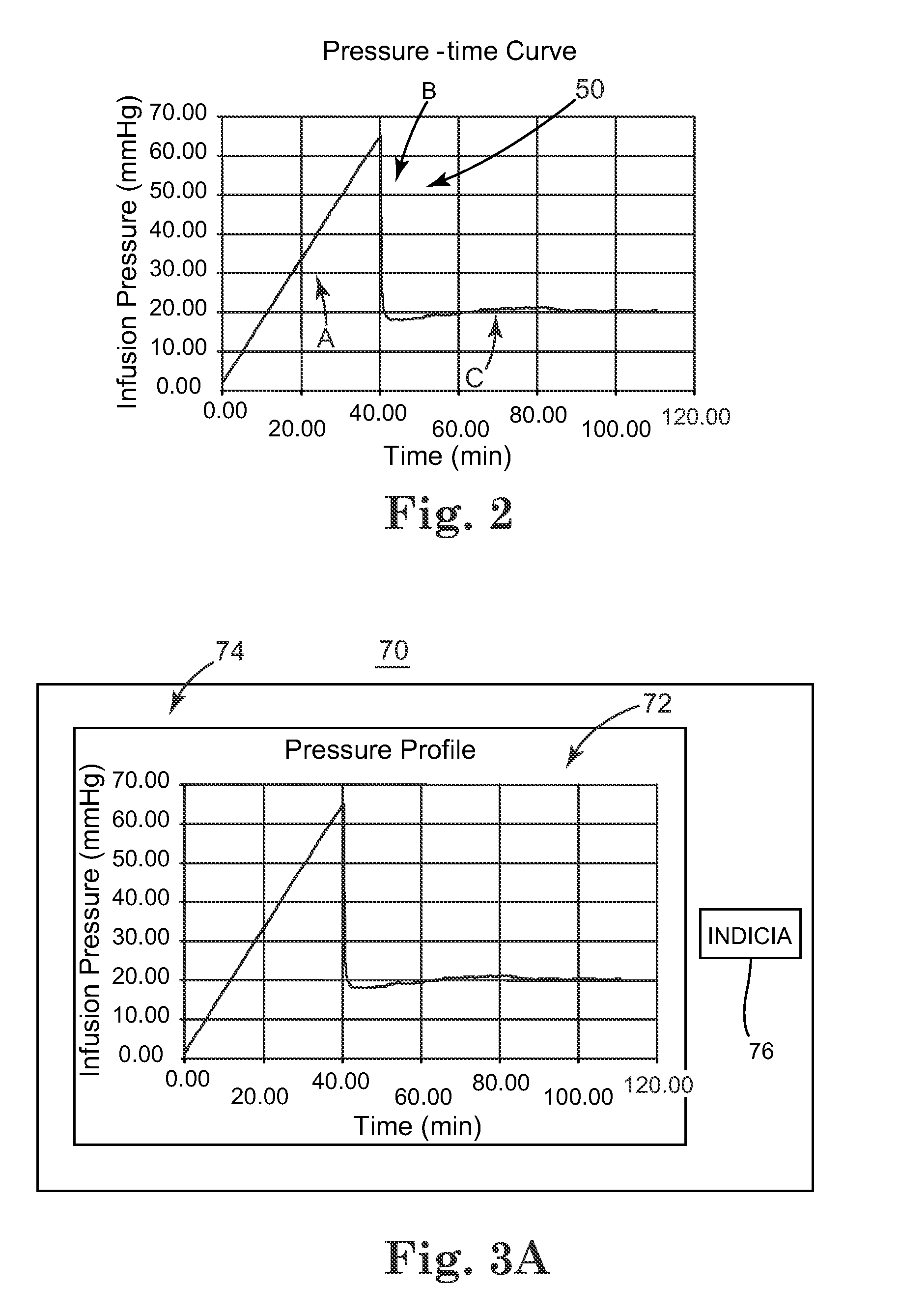 System and method for intraparenchymal drug infusion