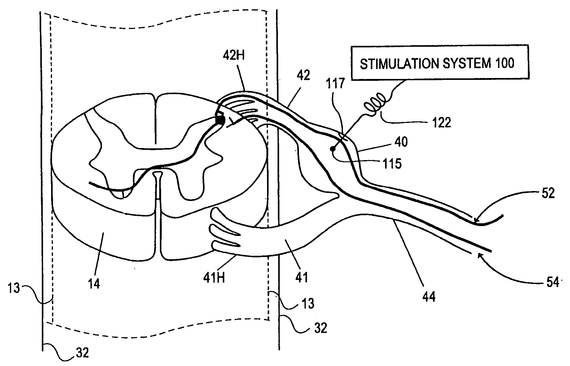 Methods for stimulating the spinal cord and nervous system