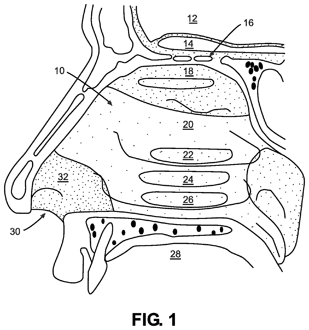 Venting of pharmaceutical drug delivery device for air flow and humidity control