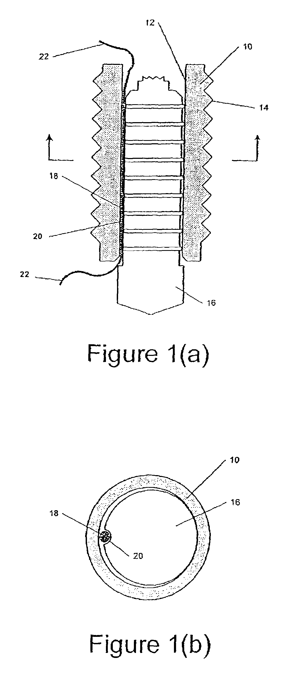 Self-locking suture anchor