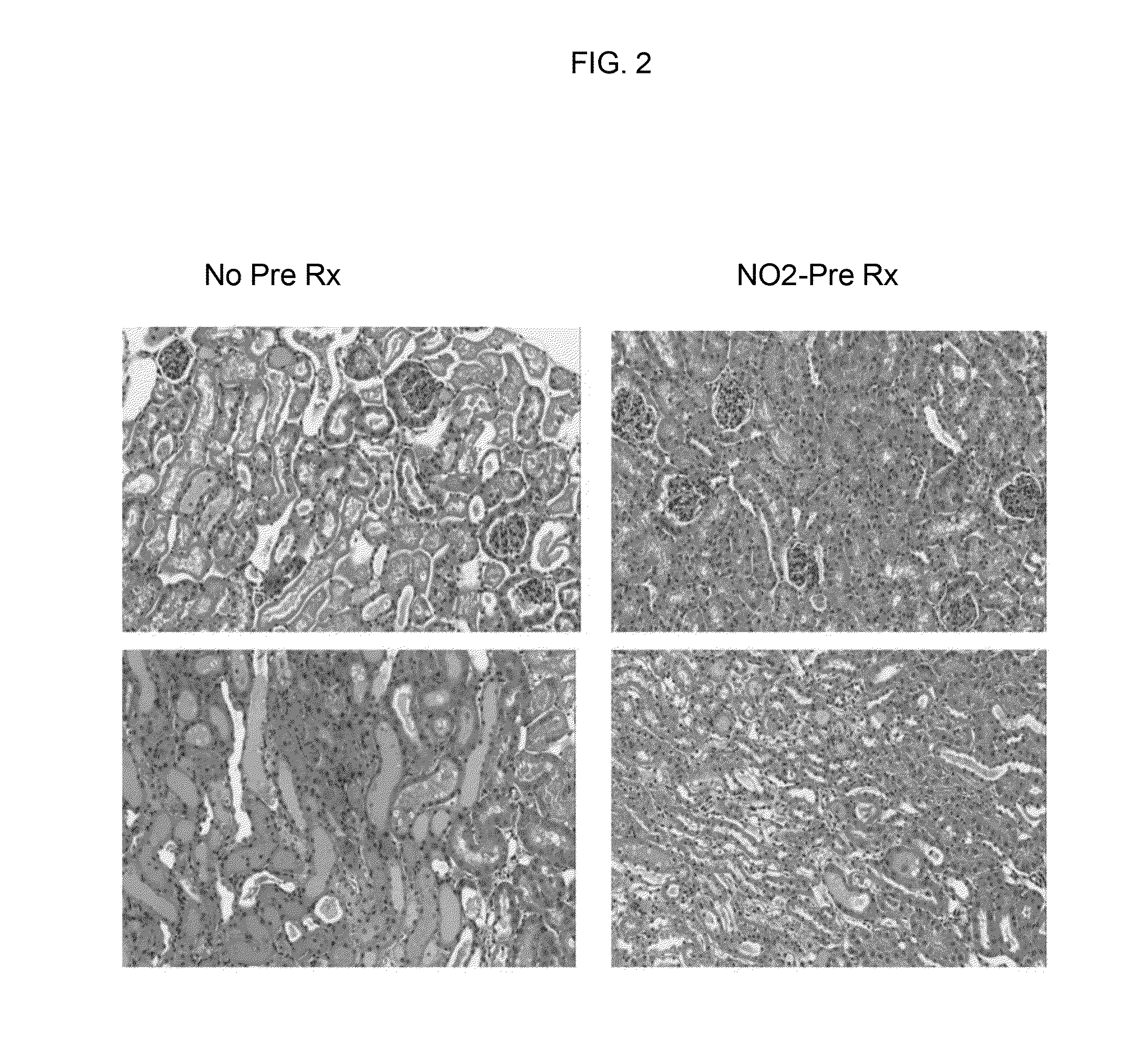 Compositions, kits, and methods to induce acquired cytoresistance
using stress protein inducers