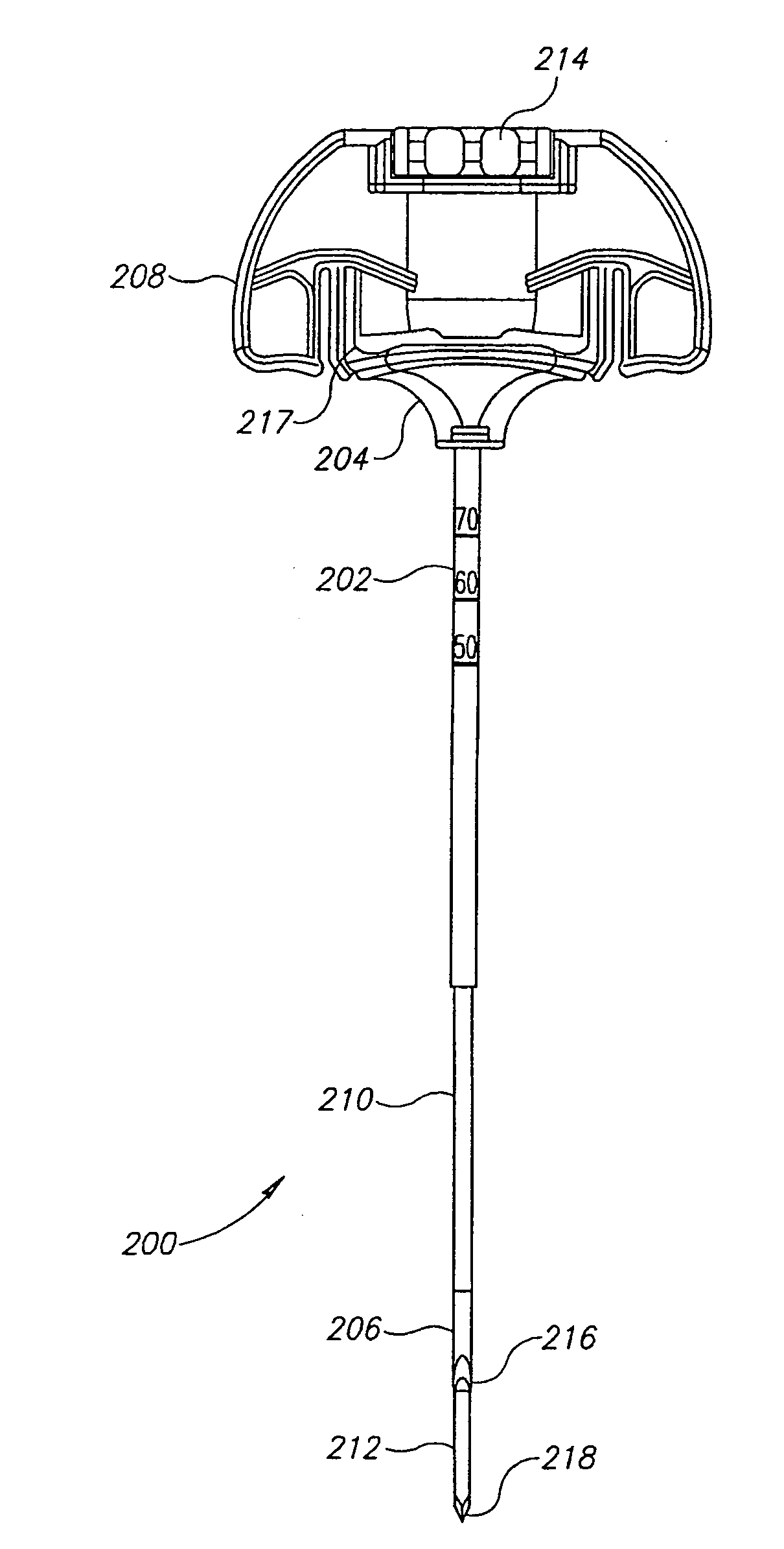 Methods, Materials and Apparatus for Treating Bone or Other Tissue