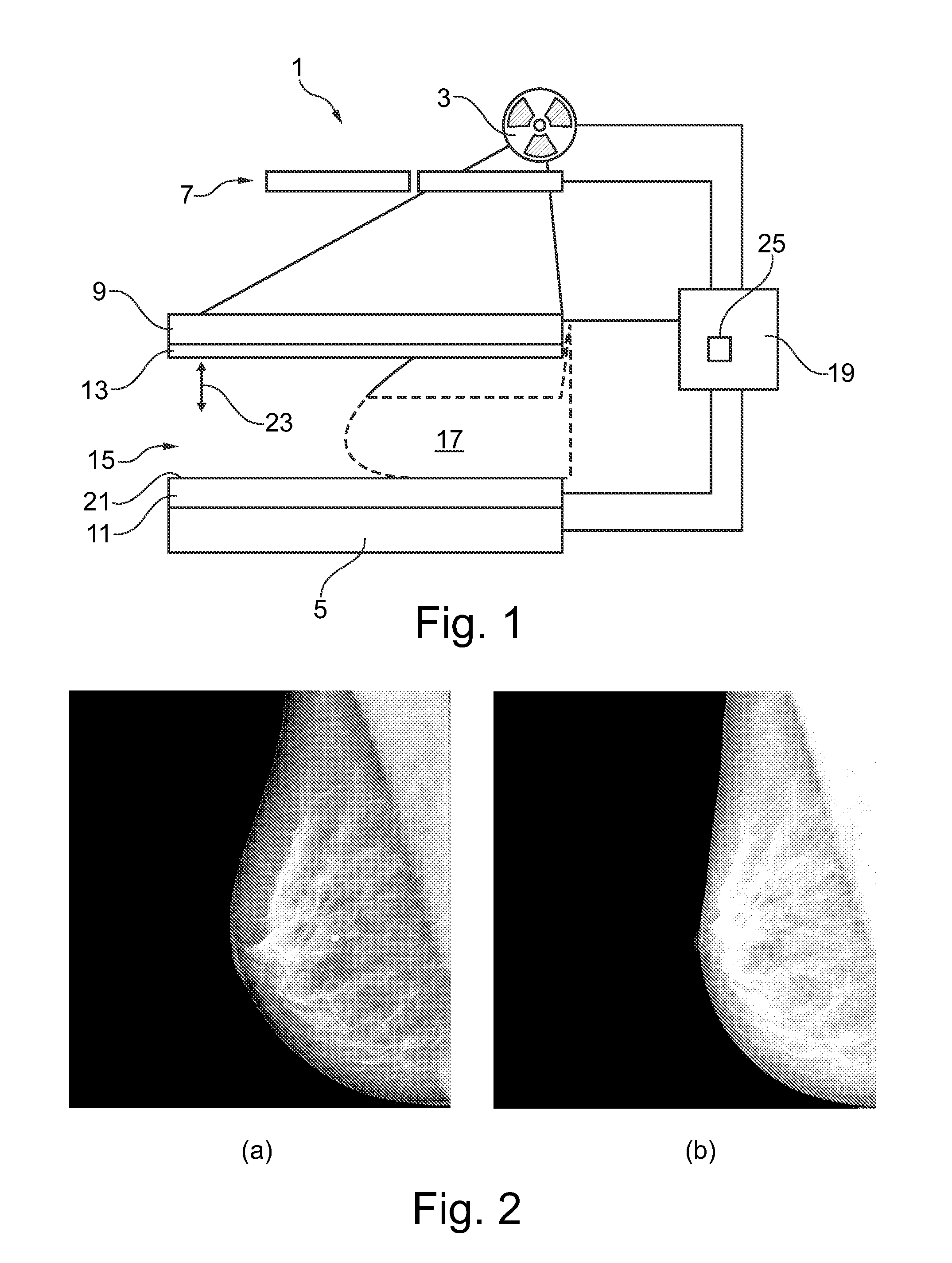 Method and device for imaging soft body tissue using x-ray projection and optical tomography