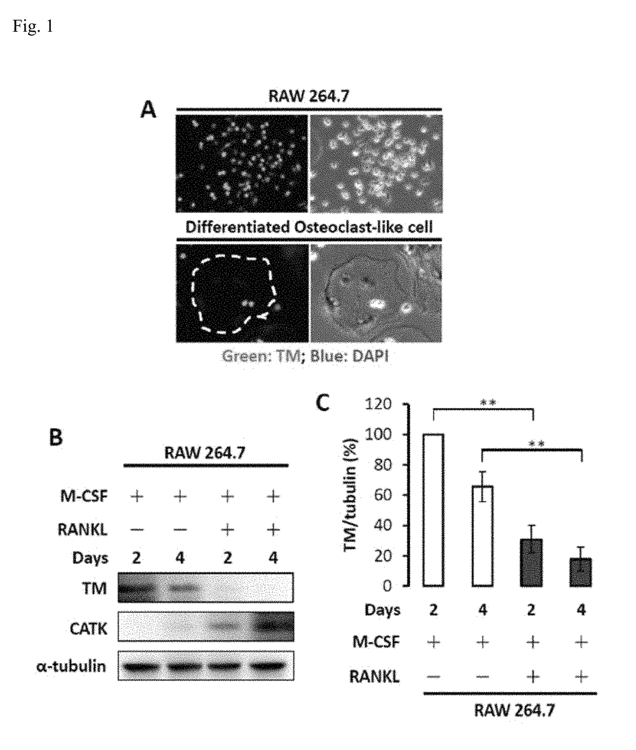 TMD1 protein for treating bone loss diseases