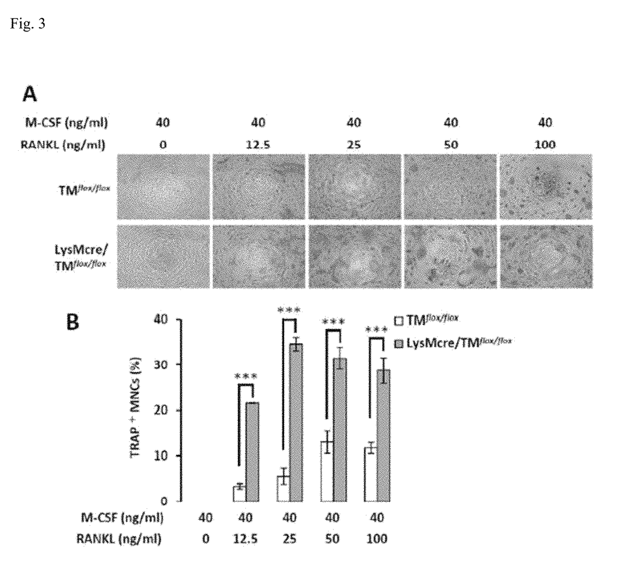 TMD1 protein for treating bone loss diseases