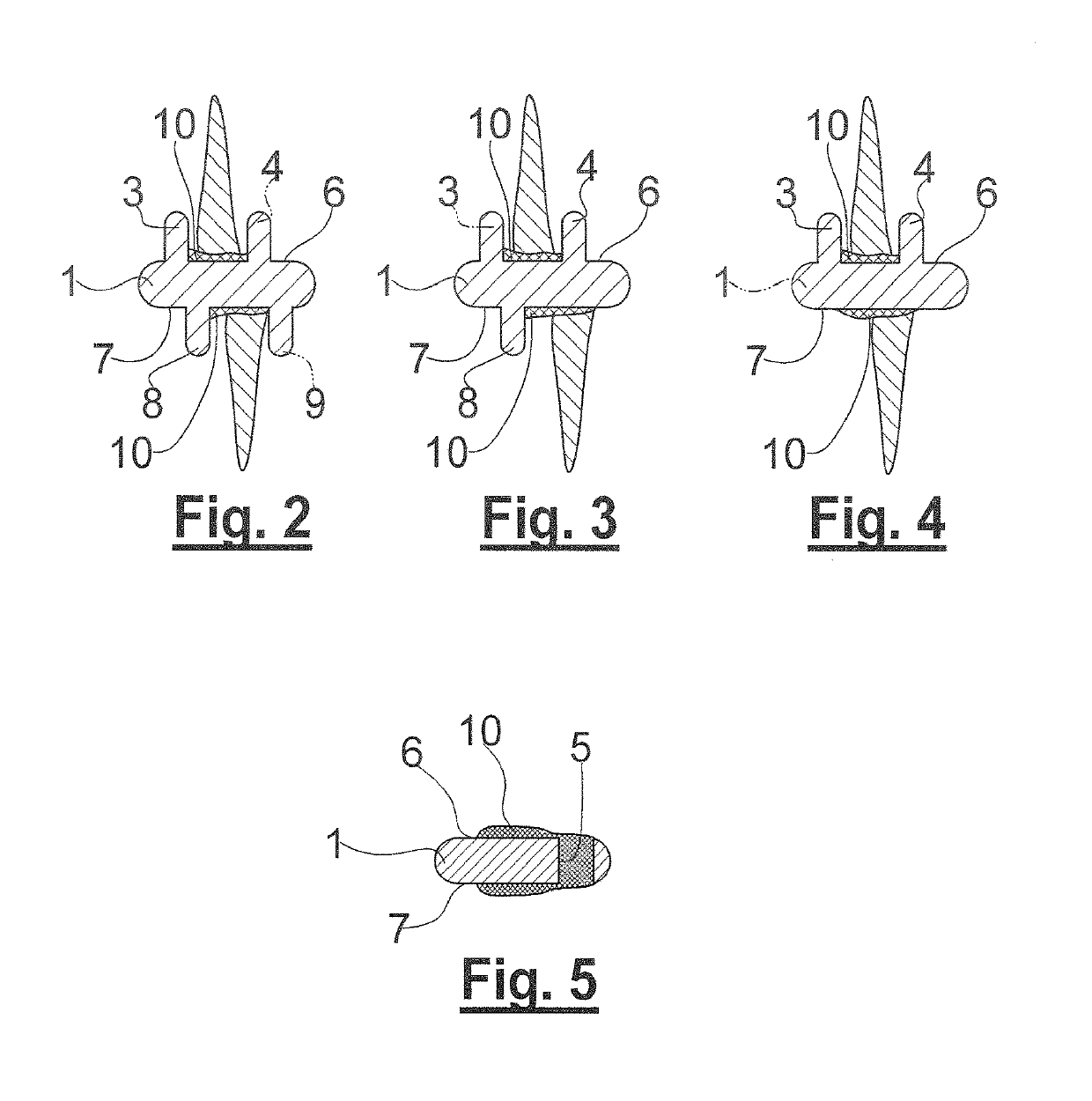 Tooth cleaning device