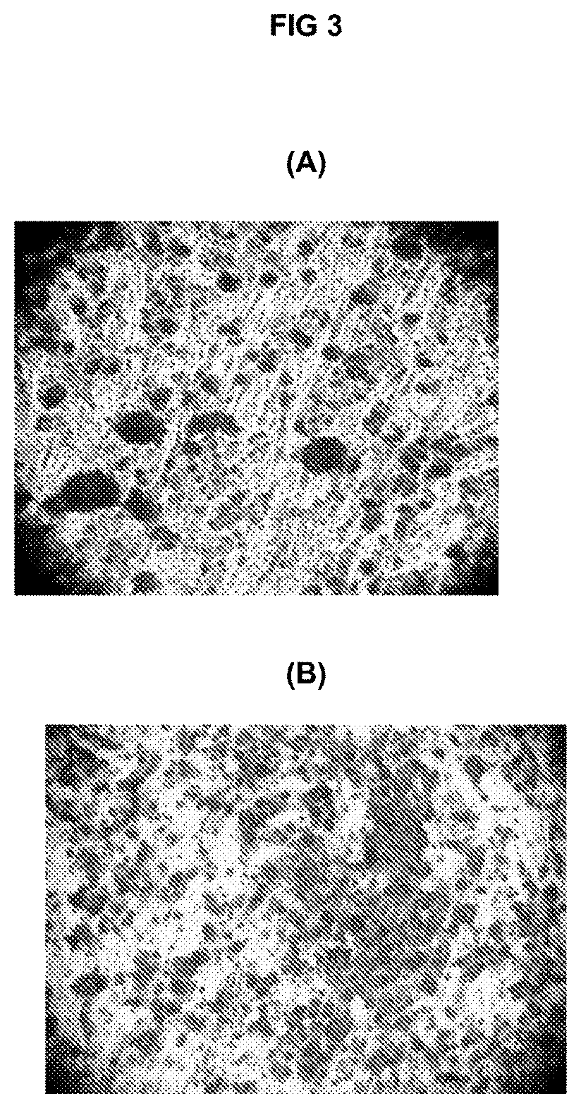 Osteogenic Differentiation of Bone Marrow Stem Cells and Mesenchymal Stem Cells Using a Combination of Growth Factors