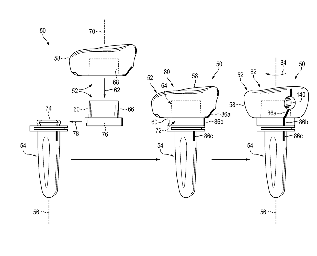 Radial head prosthesis with rotate-to-lock interface