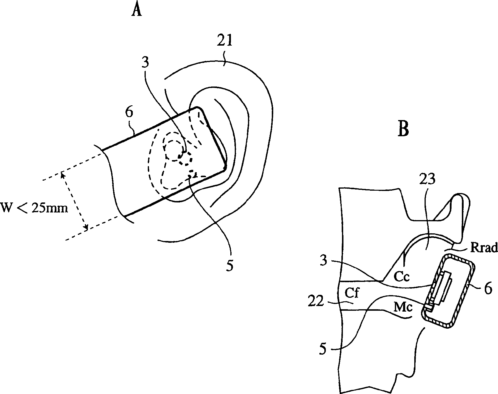 Portable accoustic apparatus