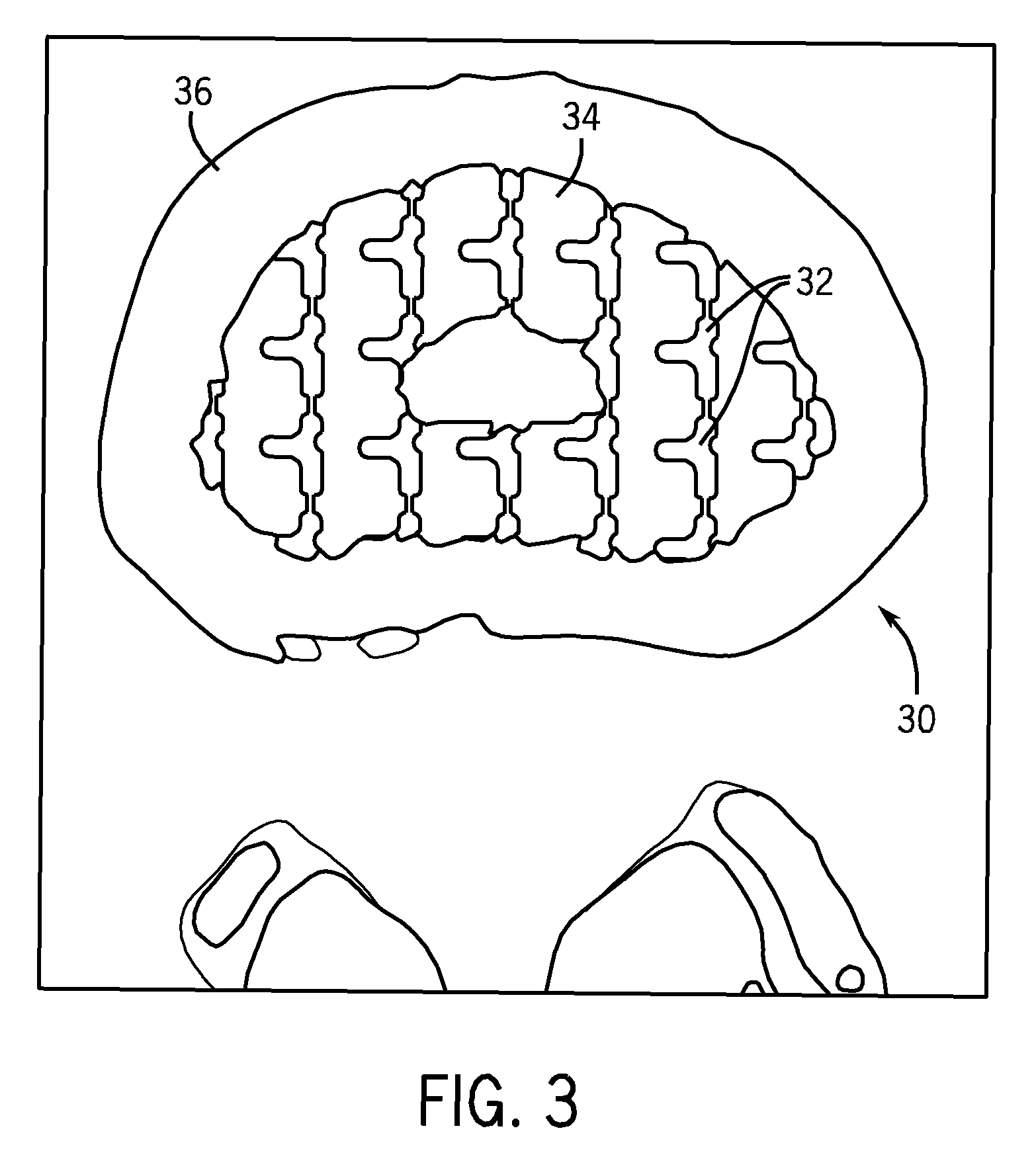 Engineered scaffolds for intervertebral disc repair and regeneration and for articulating joint repair and regeneration