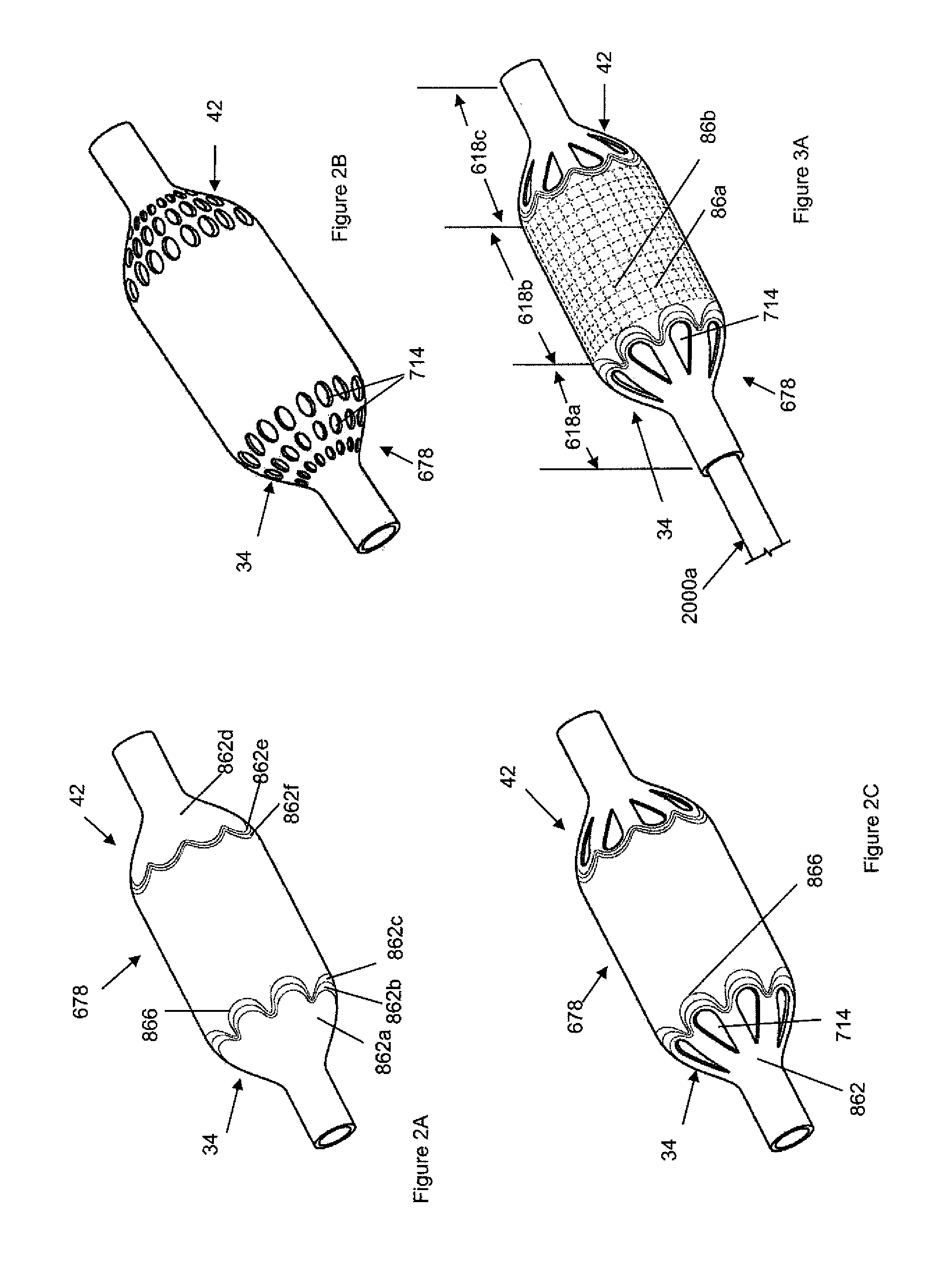 Reinforced inflatable medical devices