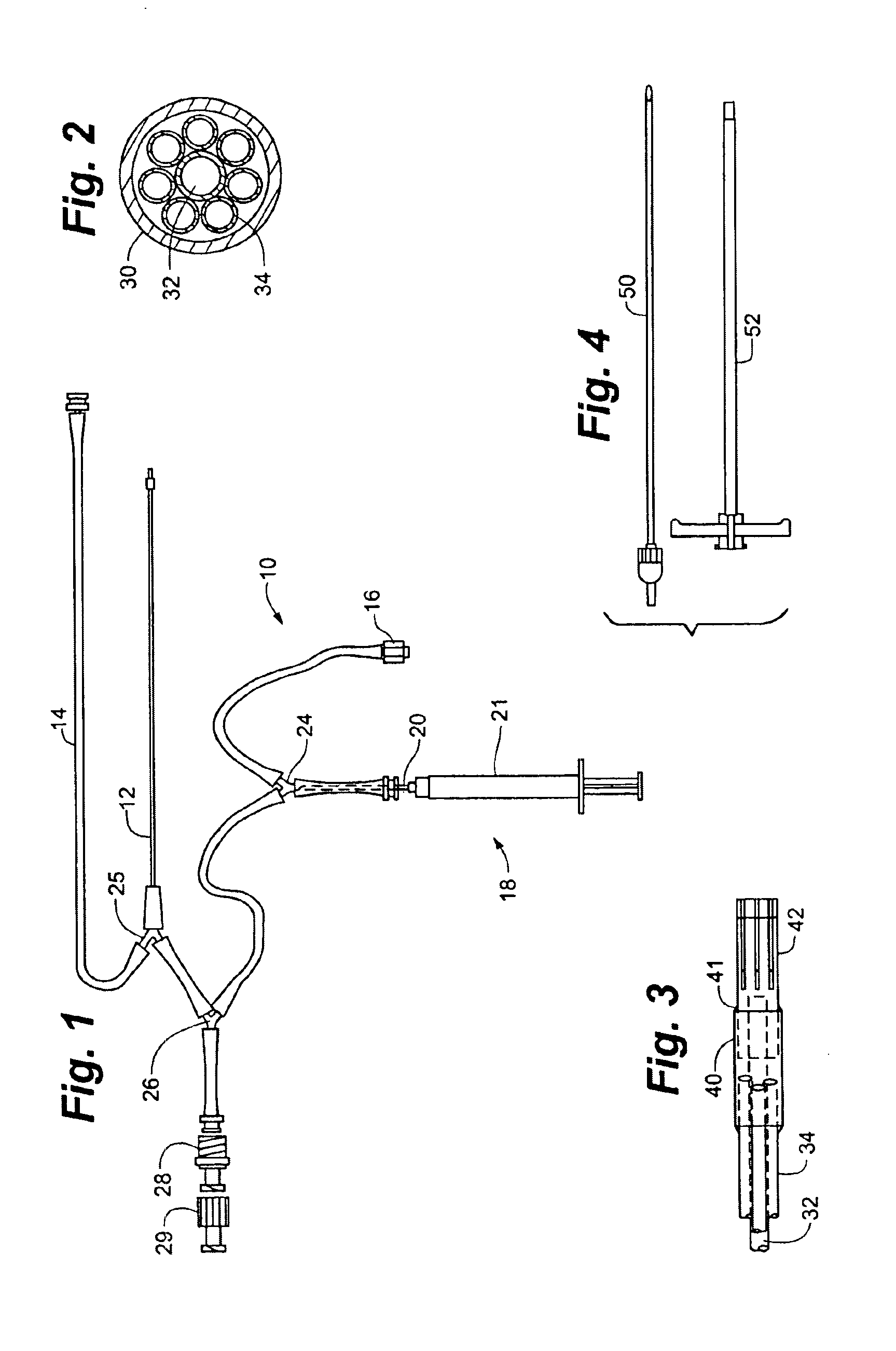 System for treating tissue swelling