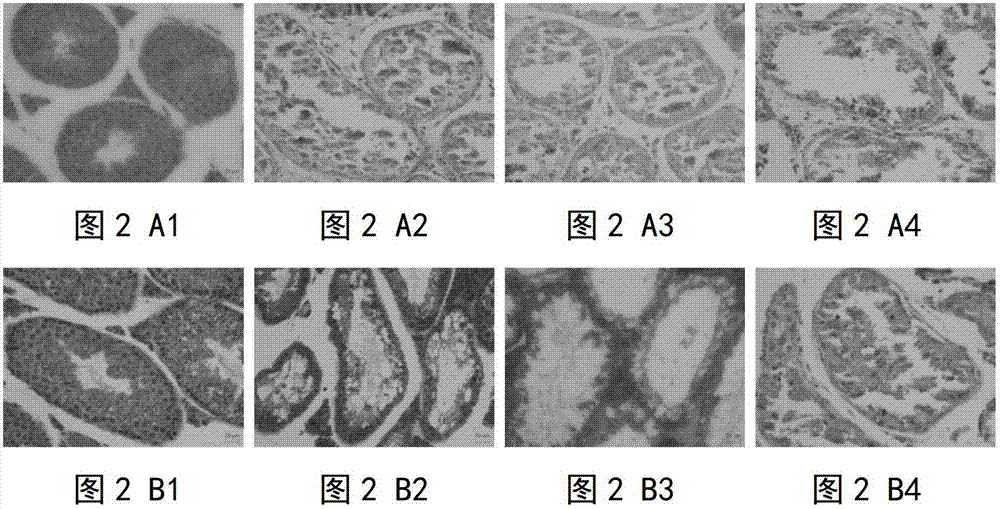 Preparation method of spermatogonial stem cell transplantation receptor