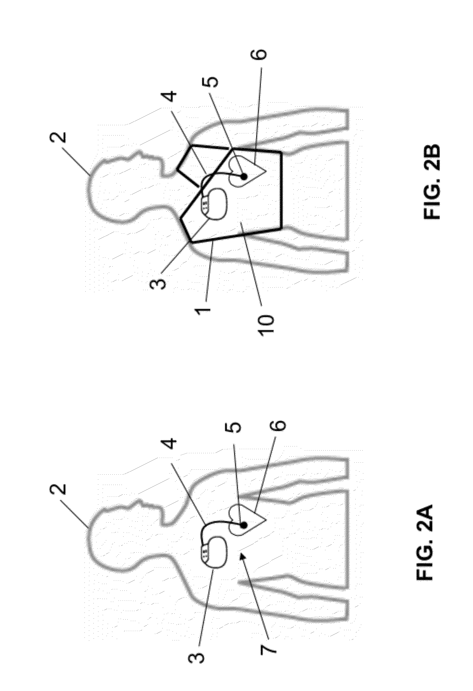 Shielding apparatus and shielding structures for magnetic resonance imaging and method for operating a magnetic resonance imaging scanner
