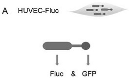 In-vitro cell model for simulating revascularization after breast cancer radiotherapy and preparation method and application of in-vitro cell model