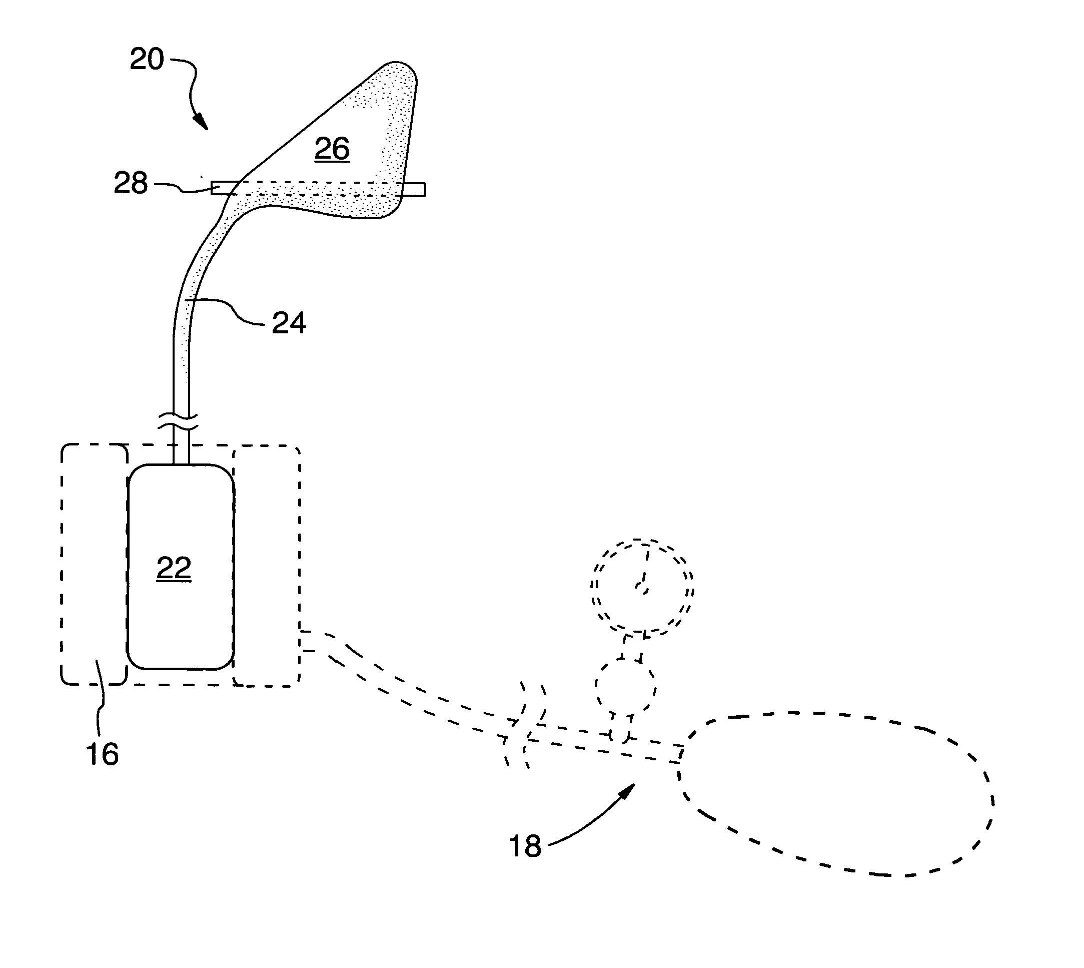 Epitaxis apparatus and method