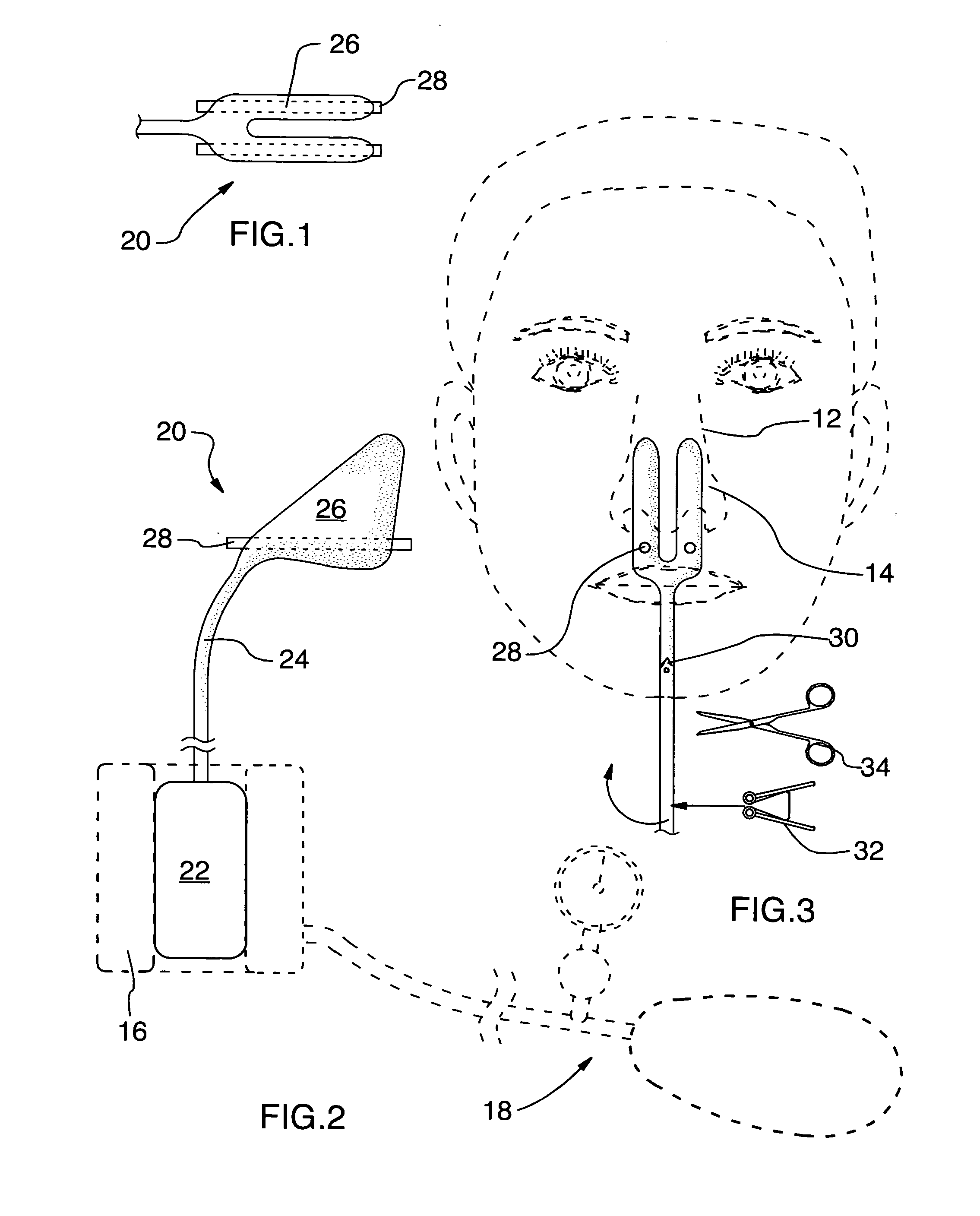 Epitaxis apparatus and method