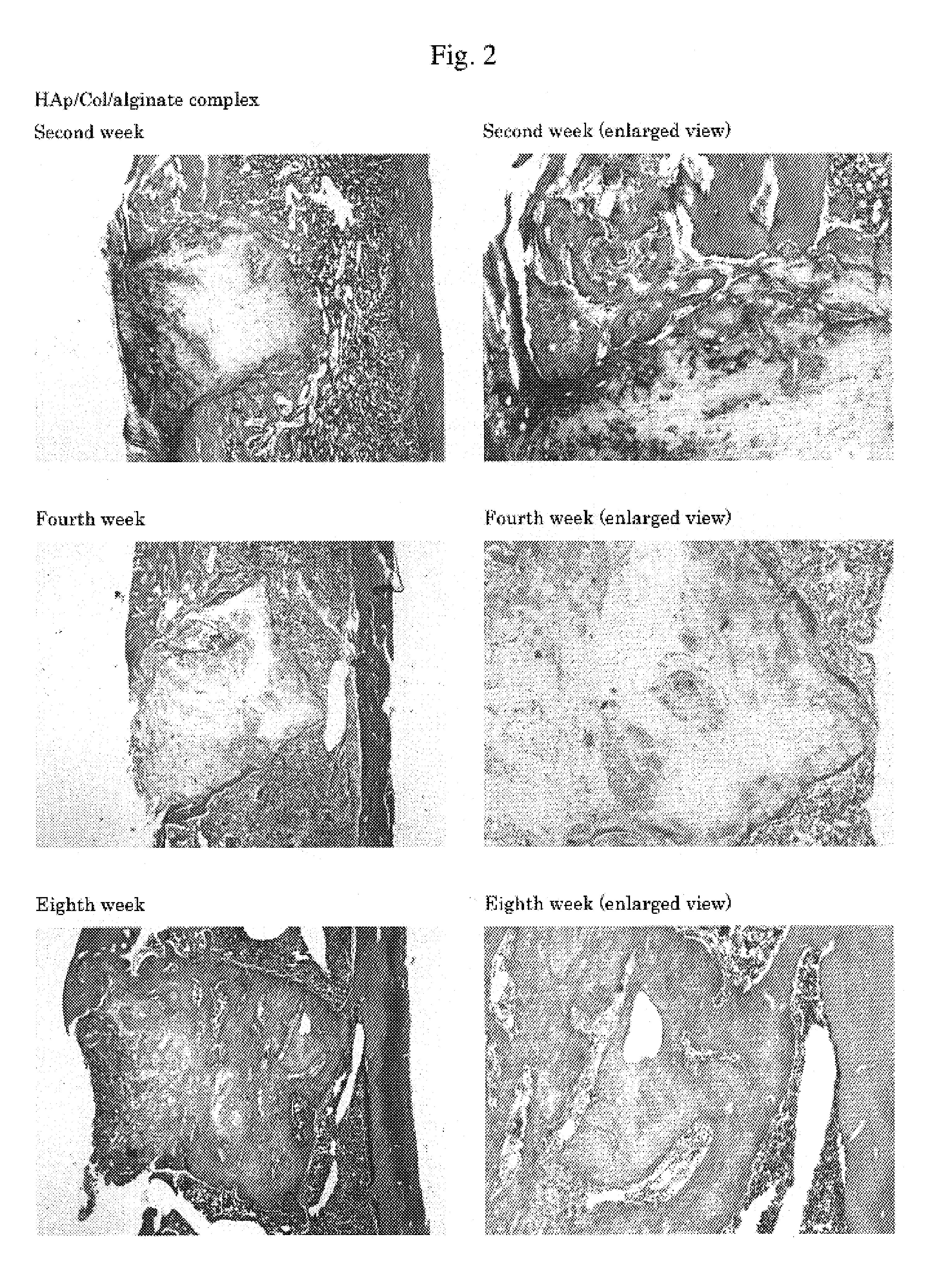 Composite biomaterials