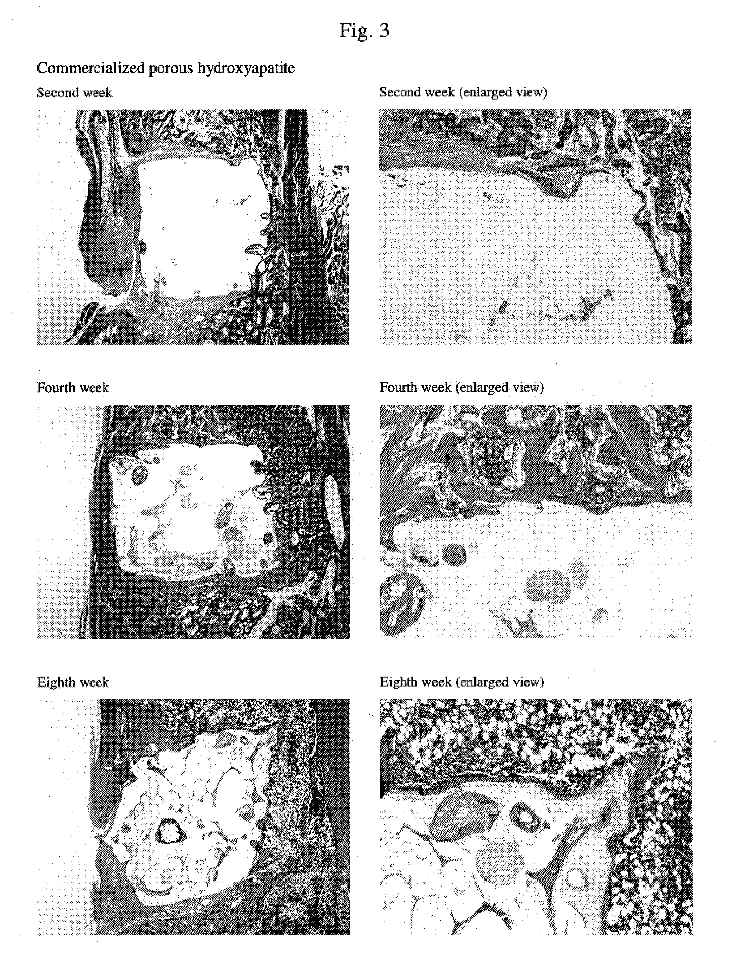 Composite biomaterials