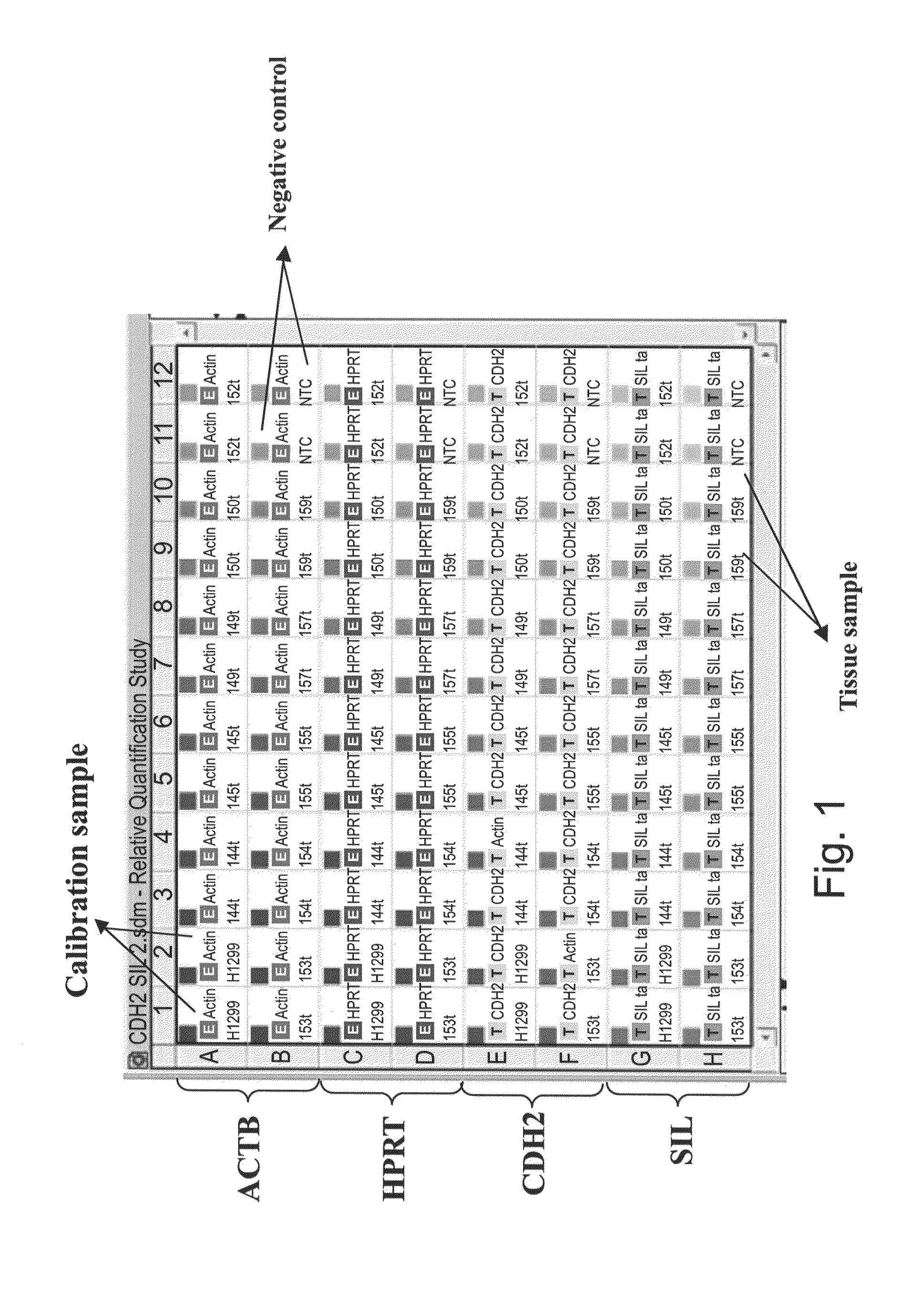 Methods and kits for predicting cancer metastasis