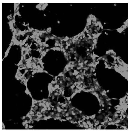 Lentivirus, recombinant mesenchymal stem cells and construction method and application of recombinant mesenchymal stem cells