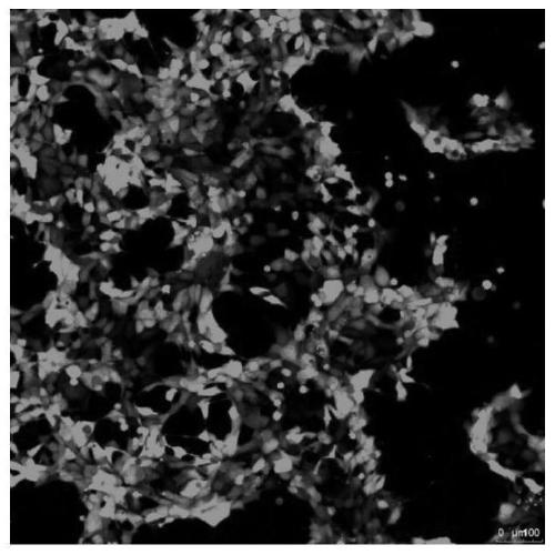 Lentivirus, recombinant mesenchymal stem cells and construction method and application of recombinant mesenchymal stem cells