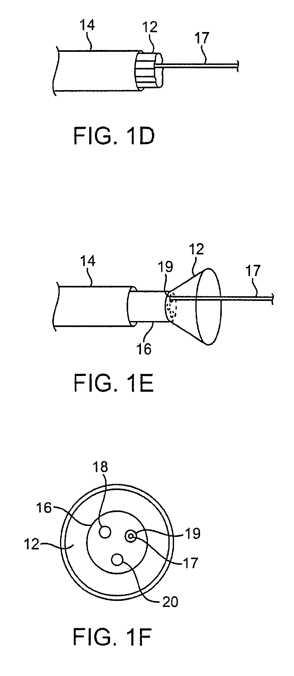 Visualization apparatus for transseptal access
