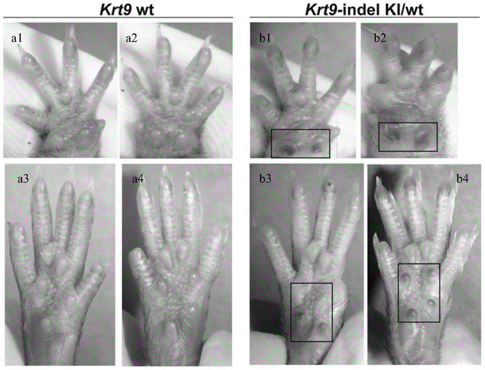 Method for constructing human epidermolytic palmoplantar keratoderma mouse model