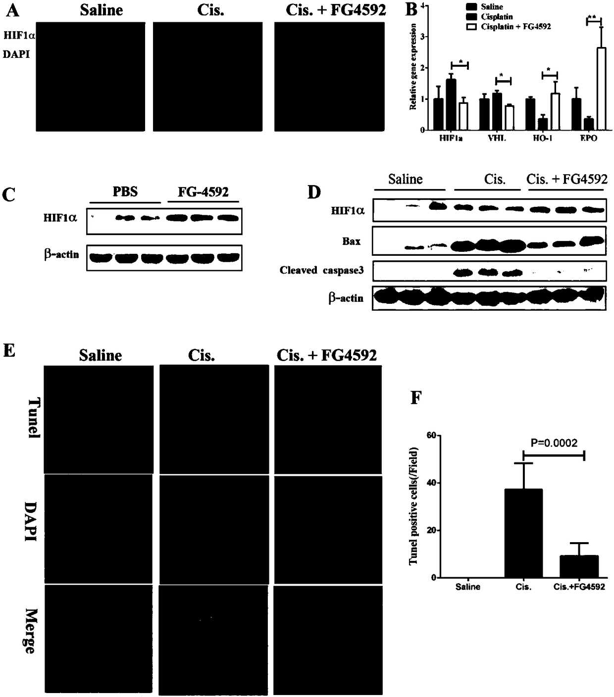 Application of hypoxia-inducible factor prolyl hydroxylase activity inhibitor in preparation of drug for preventing and treating acute kidney injury